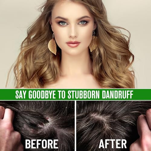 2PCS Rosemary Oil for Hair Growth Organic - 100% Pure Rosemary Oil for Eyebrow and Eyelash - Biotin and Essential Oils U229719