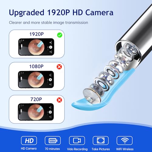 Electric Ear Wax Removal Tool with 1920 HD Camera and 6 LED Lights E7750