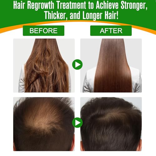 2PCS Rosemary Oil for Hair Growth Organic - 100% Pure Rosemary Oil for Eyebrow and Eyelash - Biotin and Essential Oils U229719