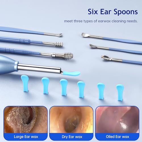 Electric Ear Wax Removal Tool with 1920 HD Camera and 6 LED Lights E7750