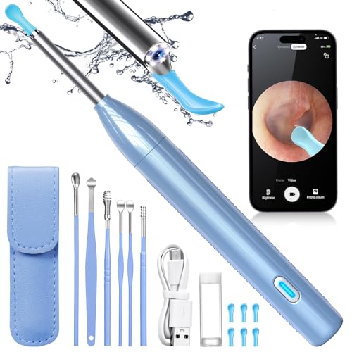 Electric Ear Wax Removal Tool with 1920 HD Camera and 6 LED Lights E7750